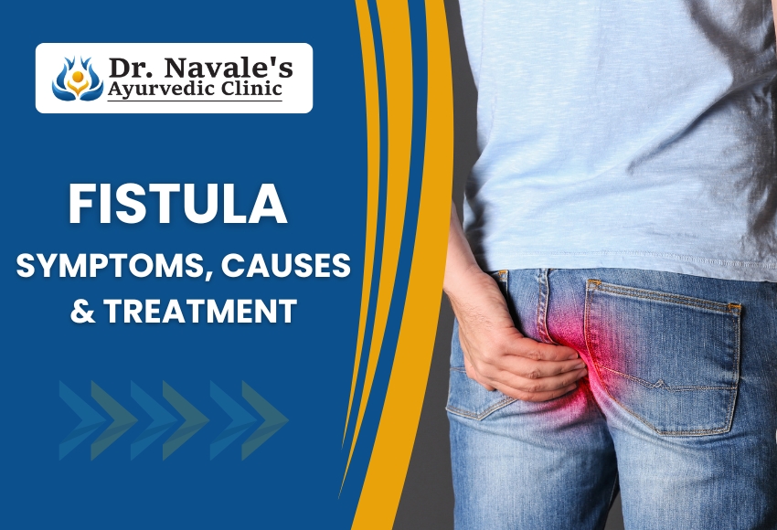 Fistula treatment in PCMC